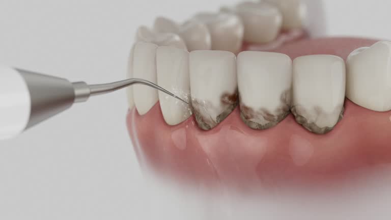 Reliable Tooth Extraction contractor in Brunswick, OH by Smile Center Dentistry